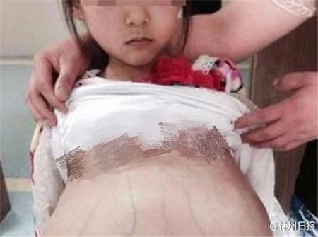 Featured image of post 15 Baby Pregnant Chinese Woman